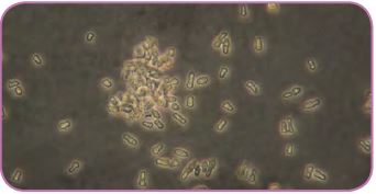 Bakterilerin ışık mikroskobundaki görüntüsü